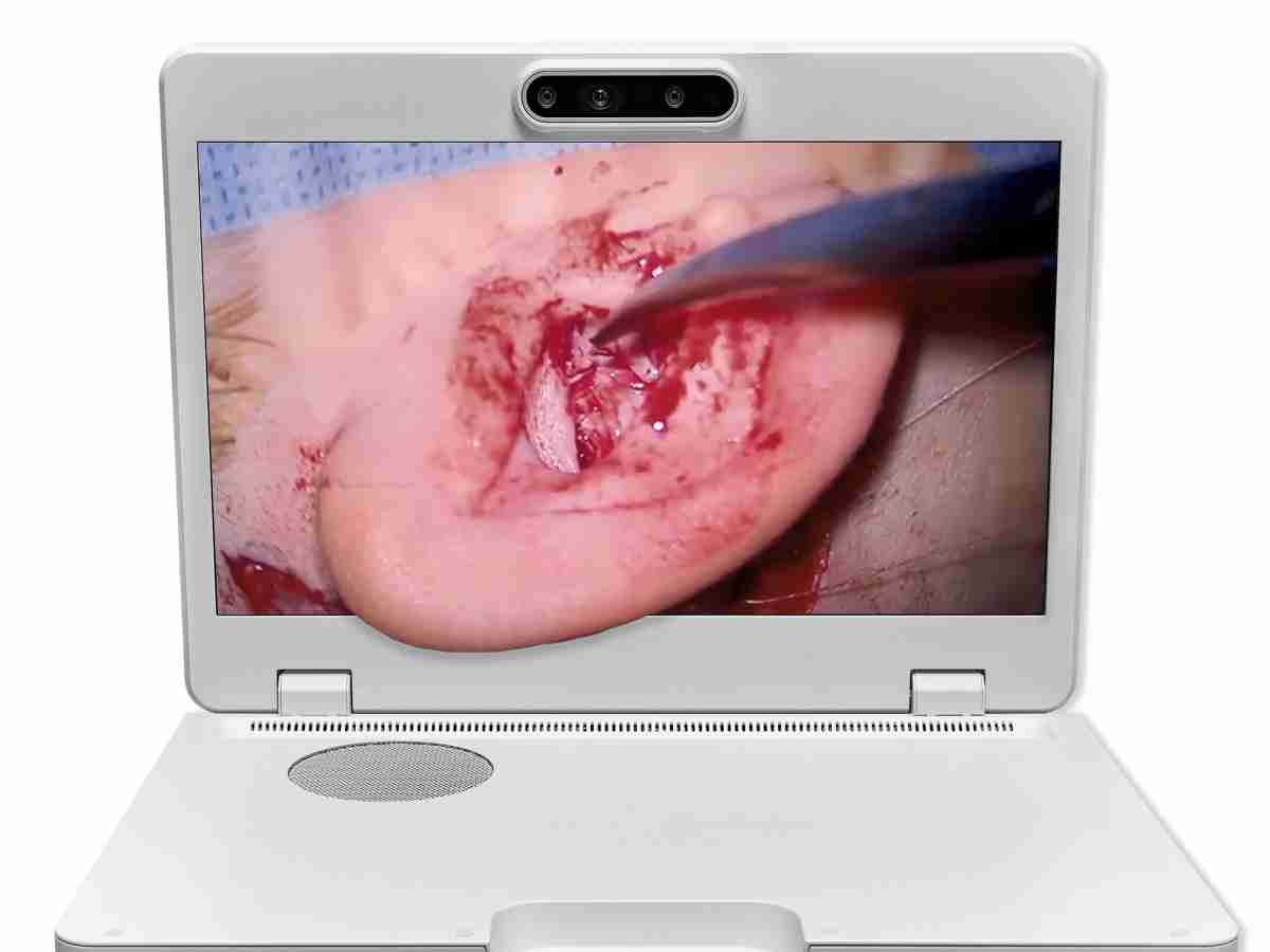 达擎之＂Heads-up 3D显微手术显示系统＂，，，整合4K裸眼3D显示及眼球追踪系统，，具备快速追踪人眼移动位置功能，，减轻医师长时间维持固定姿势的负担，，让医师能有更宽广清晰的3D立体视野及更舒适的姿势来执行手术。。